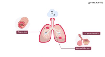 What is the lung disease COPD?