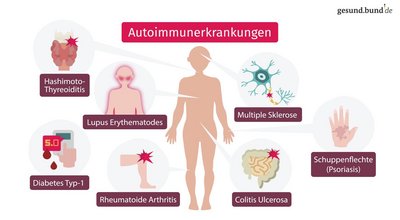 What is autoimmune disease?