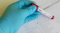Cytomegalovirus-Infektion: Eine Hand mit einem blauen Schutzhandschuh hält ein Teströhrchen über ein Formular, auf dem ein Häkchen bei Cytomegalovirus IgM gesetzt ist. Auf dem Röhrchen klebt ein Aufkleber mit dem Ergebnis CMV positiv.