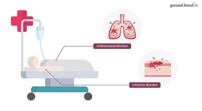 What is sepsis?