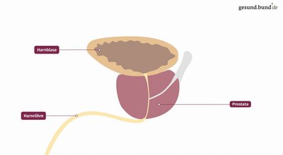 What is an enlarged prostate?