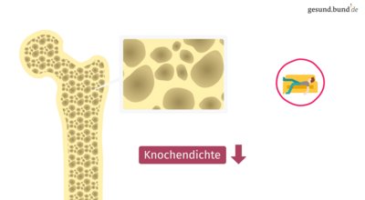 What causes osteoporosis?